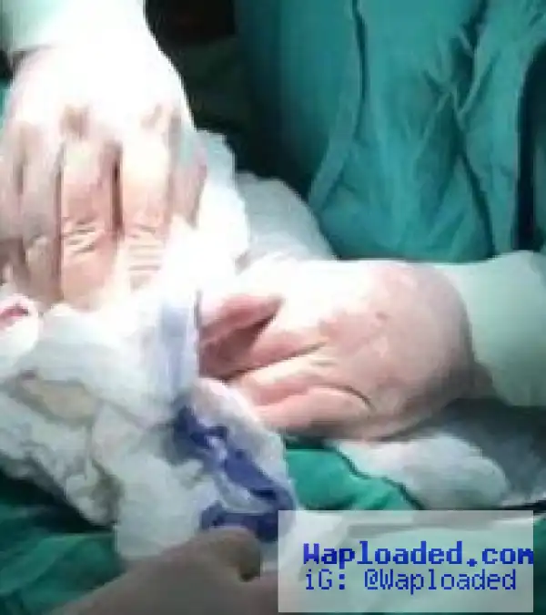 Photos: Doctors remove 18-inch cassava from man who carved it like a penis and used it as a s*x toy